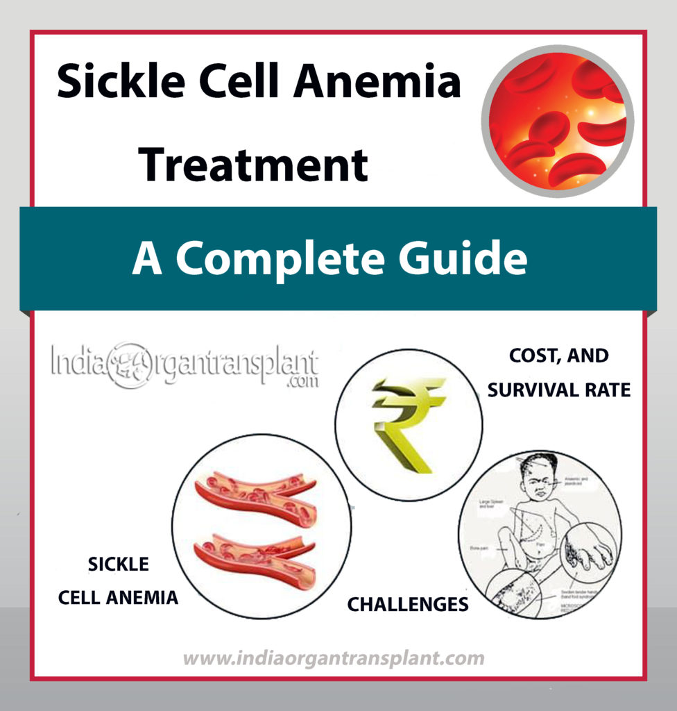 Relieving With The Early Signs And Symptoms Of Sickle Cell Treatment