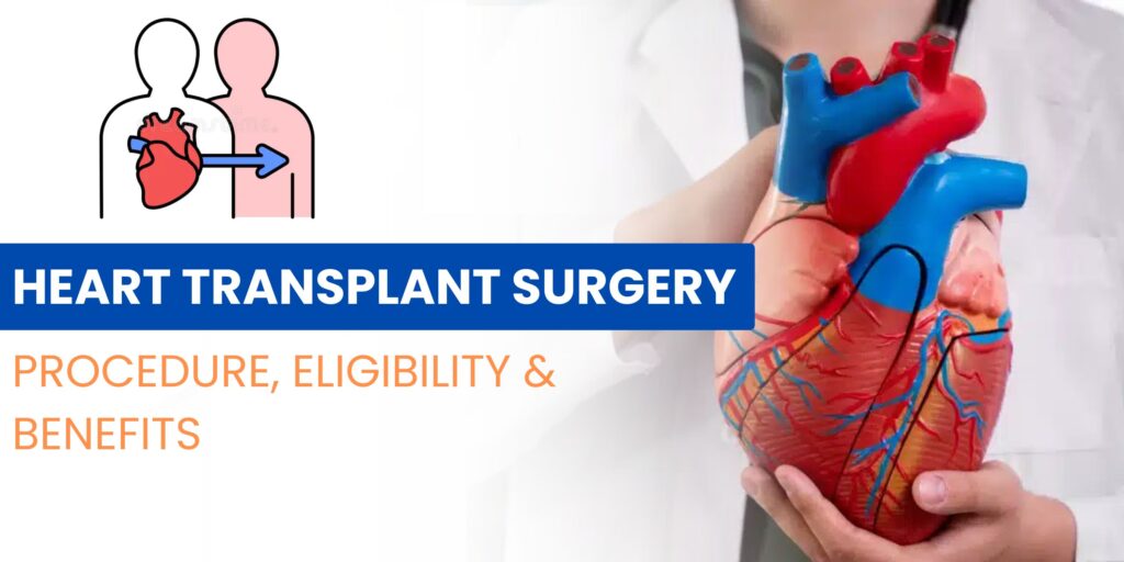 Heart transplant surgery procedure illustration