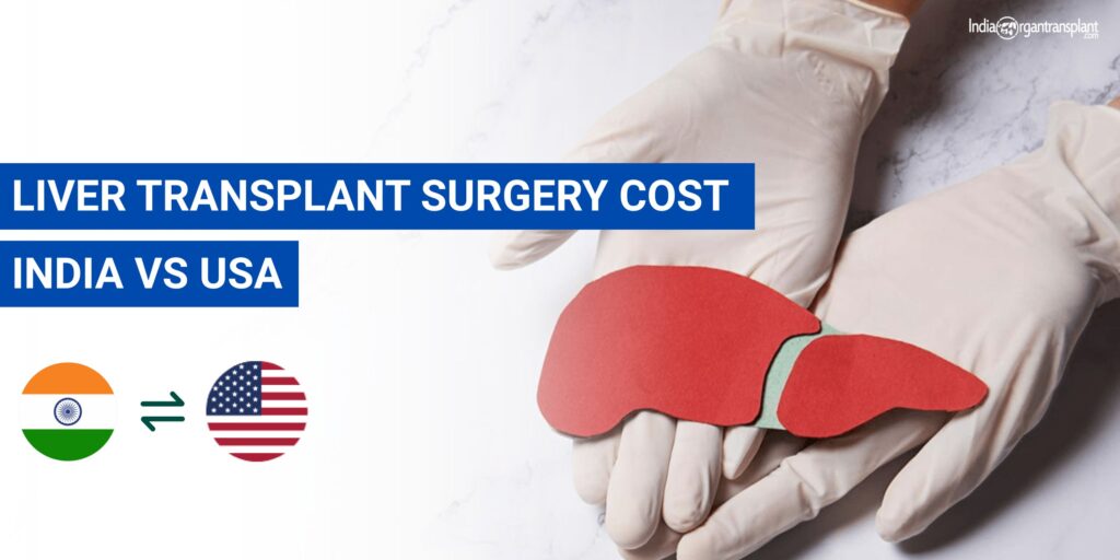 Liver Transplant Surgery Cost India vs USA comparison showing affordable treatment options and high-quality care in India